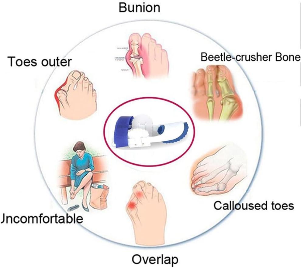 Adjustable Orthopedic Bunion Corrector Splint - Straighten Toes Relieve Pain & Realign Toes Naturally
