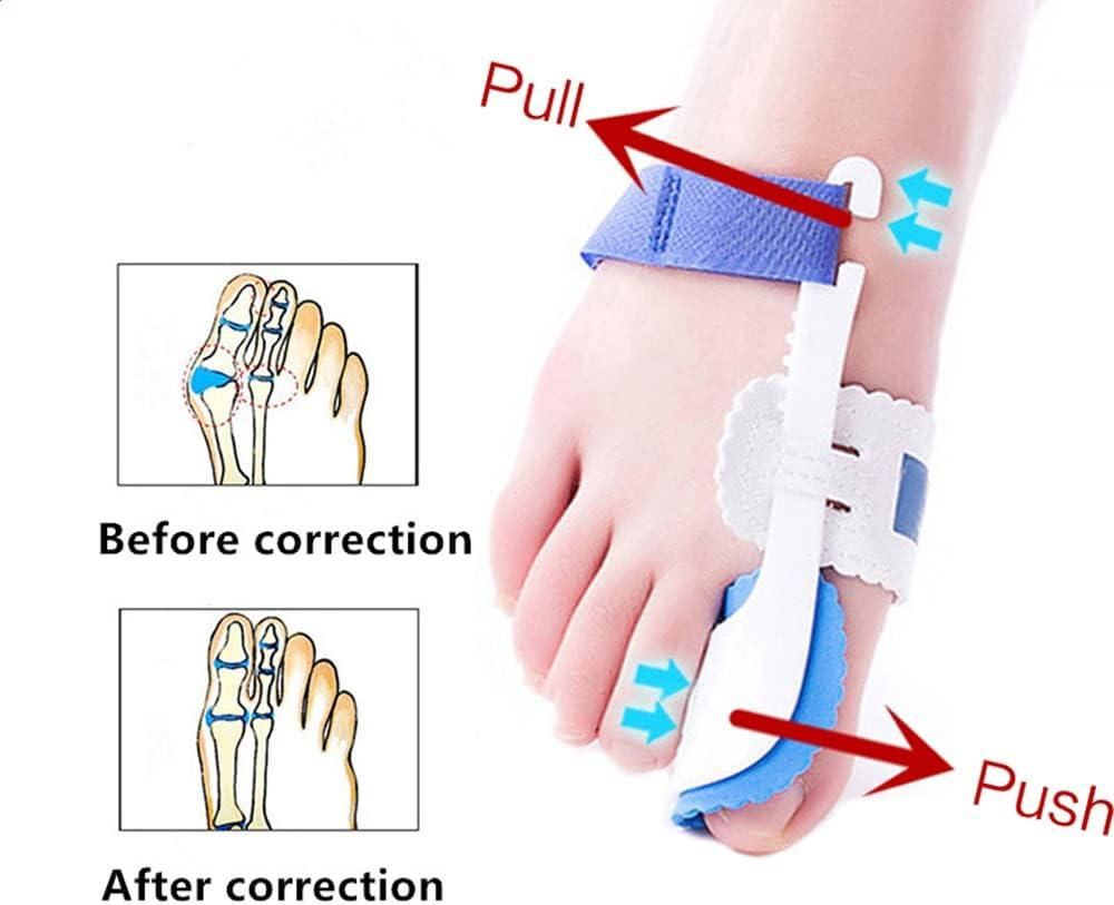 Adjustable Orthopedic Bunion Corrector Splint - Straighten Toes Relieve Pain & Realign Toes Naturally