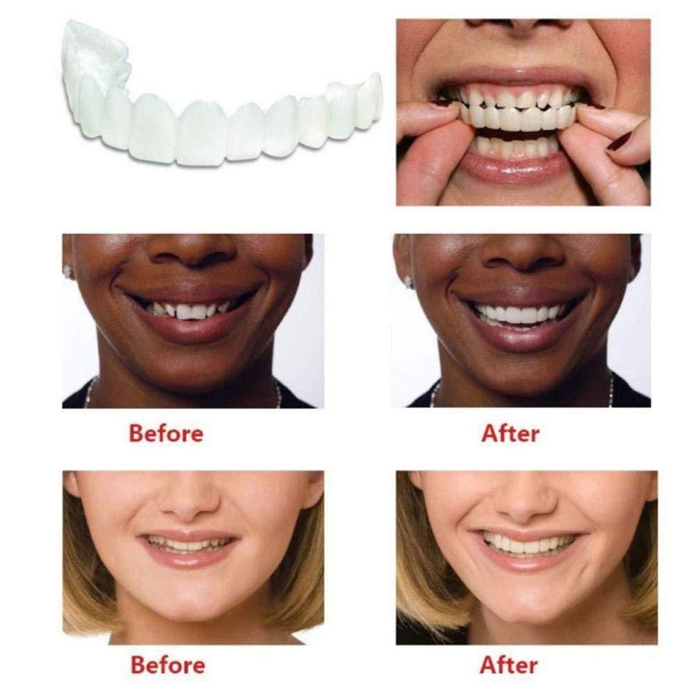 Instant and Confident on Smile Fit Flex Cosmetic Teeth Denture Teeth Default Title Khoppa